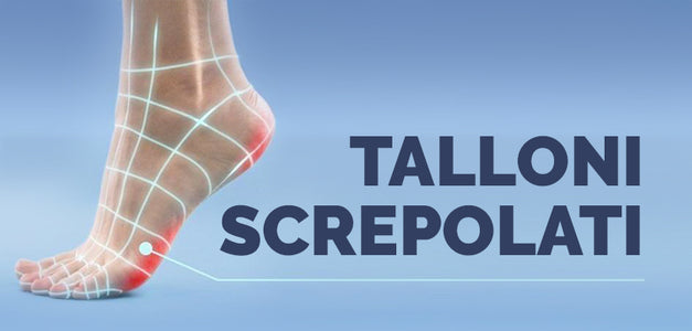 Talloni screpolati