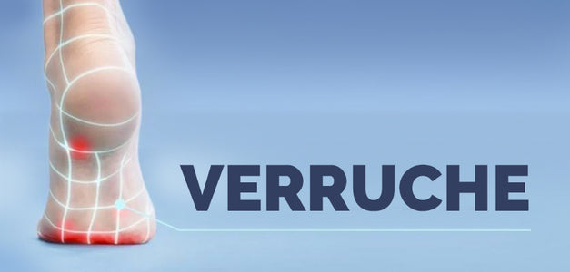 Verruche