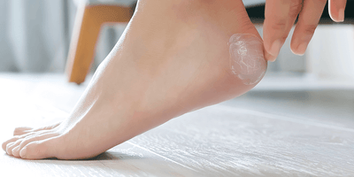 Come ammorbidire i talloni duri, secchi o screpolati