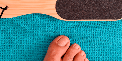 Eliminare i duroni ai piedi, come fare? La guida dell’Esperto del Piede